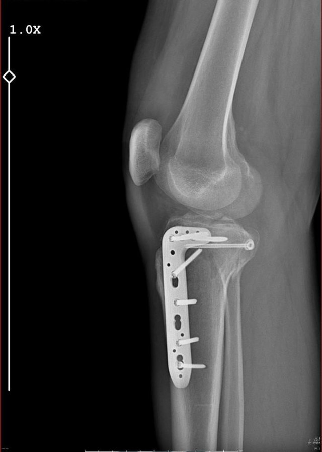 Avukata polis şiddeti: Tatil dönüşü kabusu yaşadı! Darp edildi, bacağı iki yerden kırıldı... - Resim: 4