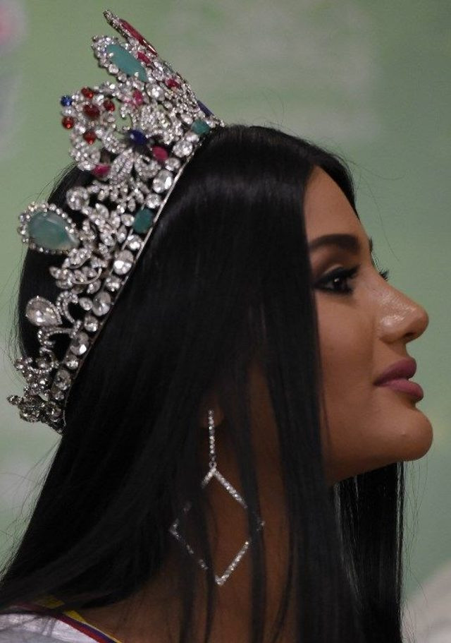 Venezuela Güzeli estetikli çıktı! Doktorundan bomba açıklama - Resim: 4