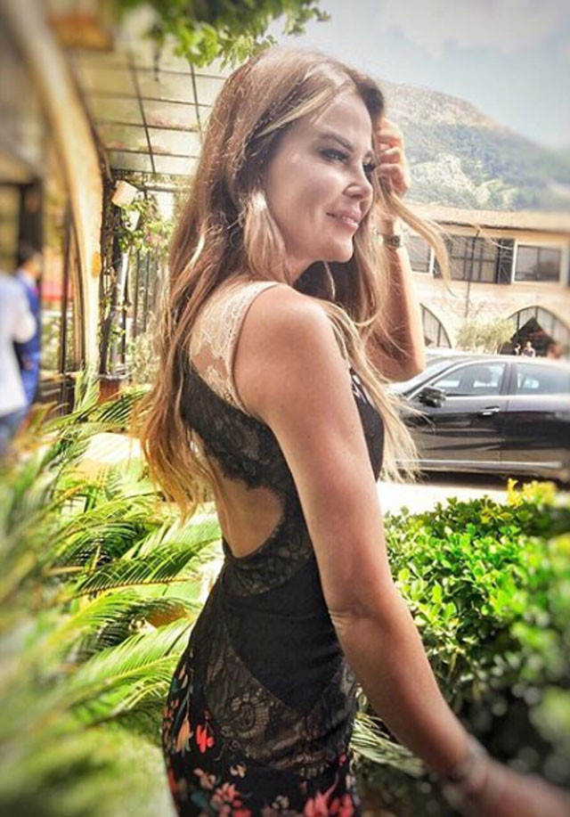 Kurşunların arasında kalan Özlem Yıldız ilk kez konuştu! Kafamı çevirdiğim an... - Resim: 1