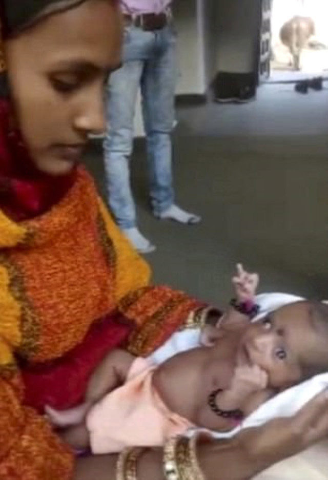 3 kollu doğan bebeği 'peygamber' ilan ettiler - Resim: 2