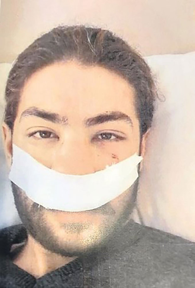 İstanbul'da istek parça saldırısı! 'Şarkıyı neden değiştirdin' deyip burnunu kırdı - Resim: 0