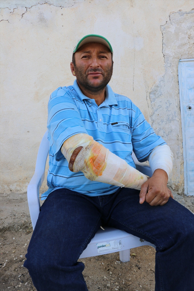 Denizli'de alevlerin arasında kalan vatandaş: Kollarımın eridiğini gördüm - Resim: 2