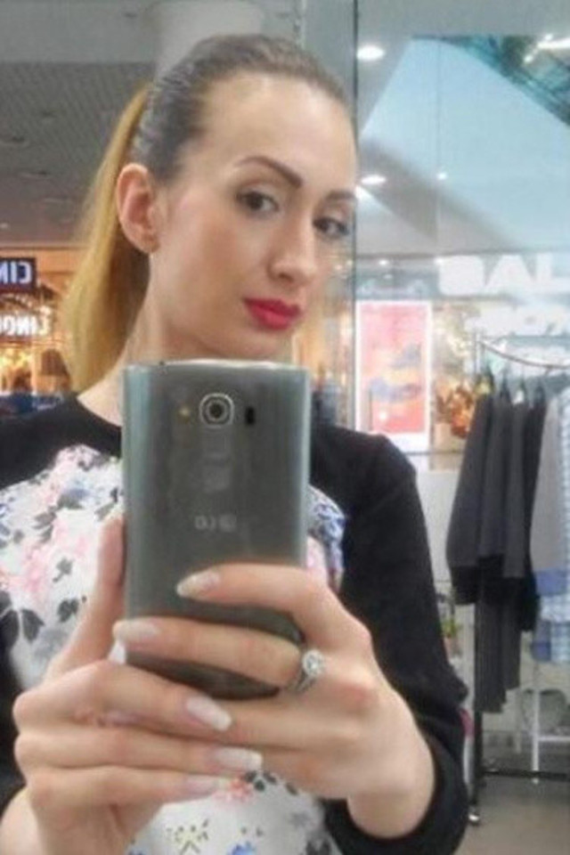 Doktorlar uyardı o vazgeçmiyor! Dünya'da tek olmak istiyor: Ameliyat için yeniden Türkiye'ye geldi! - Resim: 3