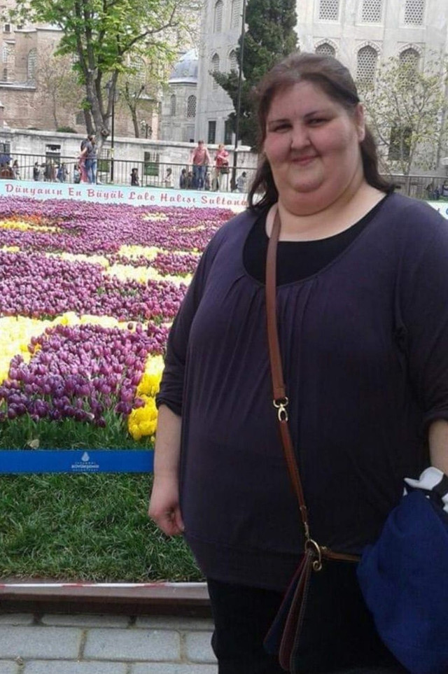 Koronadan korktu şeker ameliyatı oldu 3 ayda 32 kilo verdi - Resim: 1