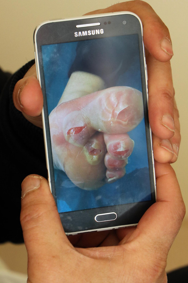 Erzurum'da başına gelene o da inanamadı! Kamyon şoförünün ayakları dondu - Resim: 1