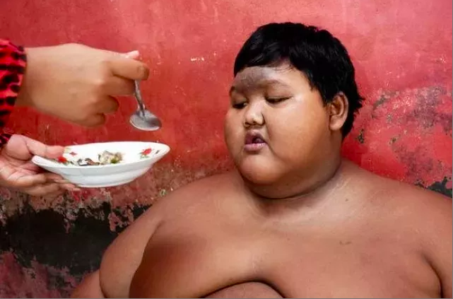 Dünyanın en şişman çocuğuydu herkes ölmesini beklerken son hali inanılmaz! - Resim: 2