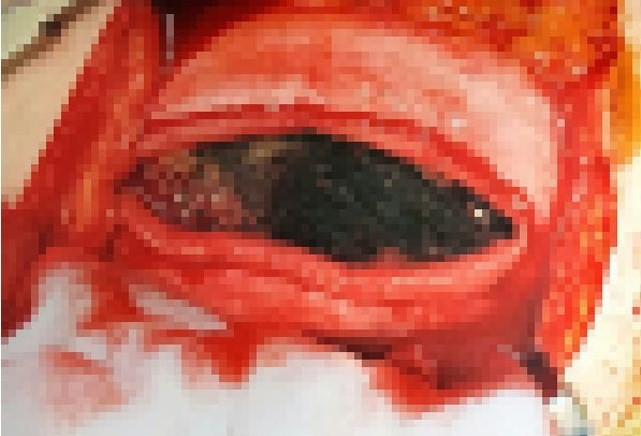 Karnından çıkanlar şok etti - Resim: 3