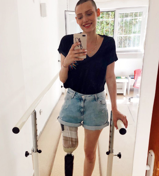 Neslican Tay hastalığı ne yoğun bakıma alınan gencin doktorundan ilk açıklama - Resim: 2