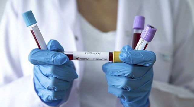 Koronavirüsün en gerçekçi görüntüsü ortaya çıktı! - Resim: 1