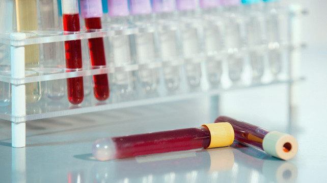 Şekeri rafa kaldırmayın çöpe atın! - Resim: 4