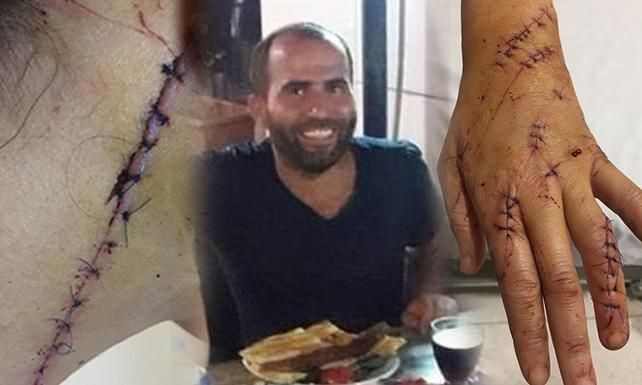 Adana'da platonik aşkı tarafından bıçaklandı kimse iş vermiyor - Resim: 3