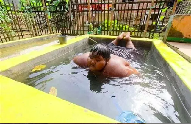 Dünyanın en şişman çocuğuydu herkes ölür derken son hali inanılmaz! - Resim: 3