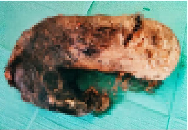 Karnından çıkanlar şok etti - Resim: 4