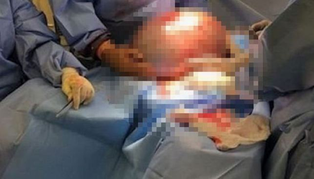 Herkes kilolarıyla dalga geçti işin aslı bambaşka çıktı - Resim: 3