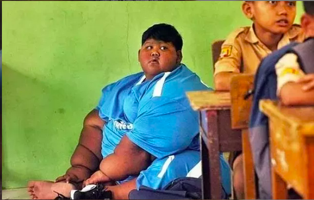 Dünyanın en şişman çocuğuydu herkes ölür derken son hali inanılmaz! - Resim: 4