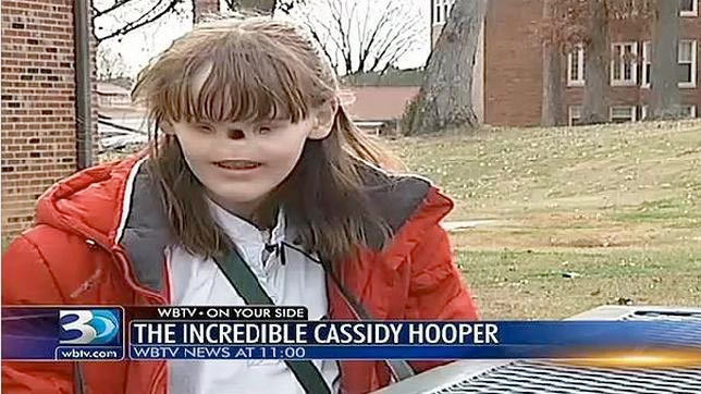 Burun ve gözü olmayan kız - Resim: 2