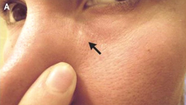 Yüzü birden bu hale gelmeye başladı içinden çıkanlar ise inanılmaz - Resim: 1