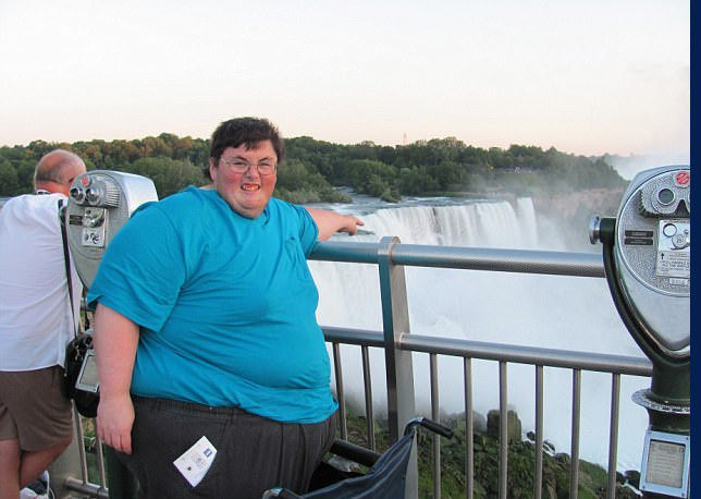 Tam 308 kiloydu ve bir bacağı yoktu değişimi ise inanılmaz - Resim: 2