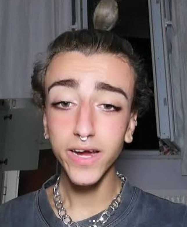 Instagram fenomeni Mika Can Raun estetik operasyon geçirdi Mika Raun kimdir işte son hali - Resim: 1