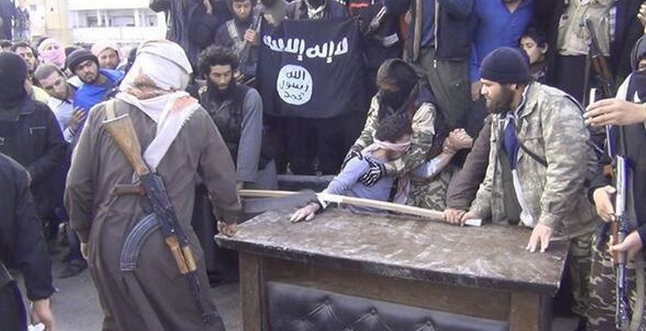 Hırsızlık zanlısının elini kestiler - Resim: 2