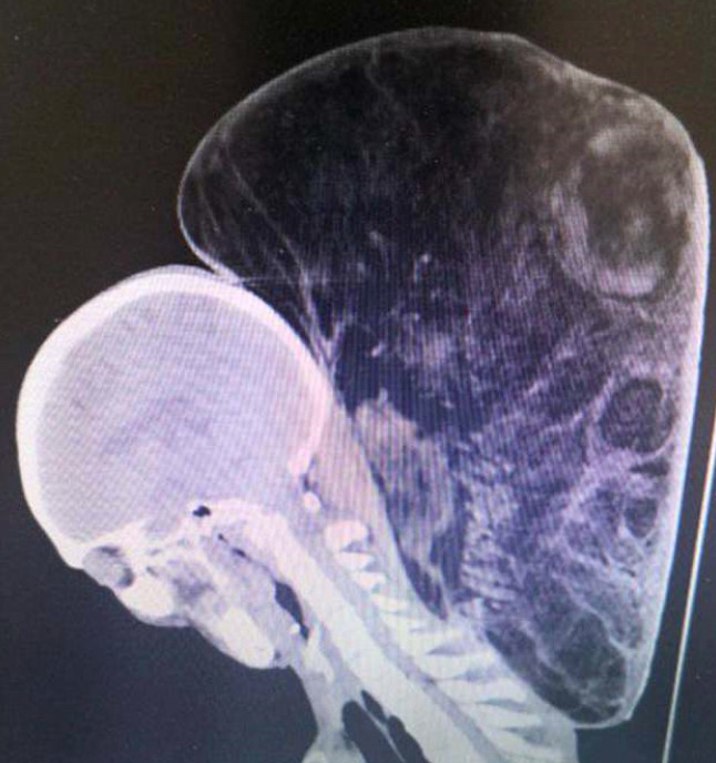 Boynunu görenler korkup kaçıyordu tam 15 kilo! - Resim: 3