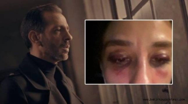 Rubato'nun solisti Özer Arkun hakim karşısına çıktı sevgilisini dövüp kanları temizlemişti - Resim: 3