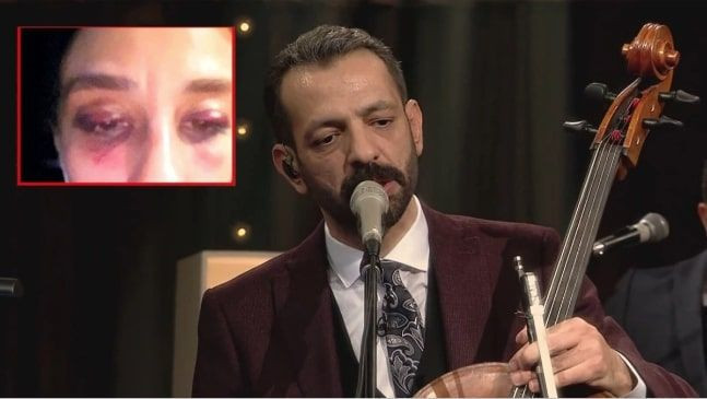 Rubato'nun solisti Özer Arkun hakim karşısına çıktı sevgilisini dövüp kanları temizlemişti - Resim: 1
