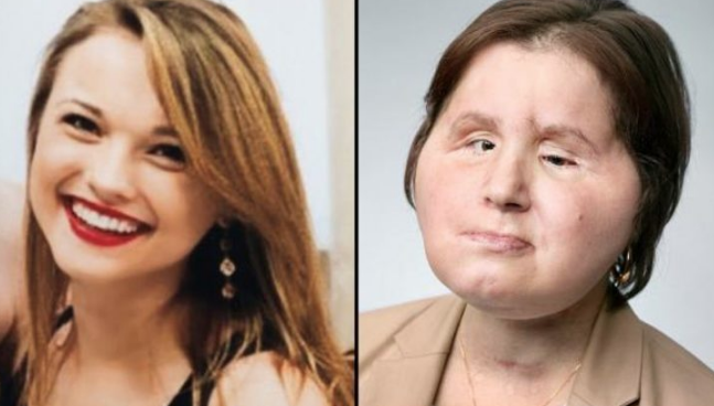 Aldatıldı intihar etmeye çalıştı! Genç kızın ilham verici öyküsü... - Resim: 2