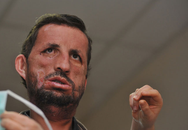 Yüzünü bu kadar yakından gördünüz mü? - Resim: 4