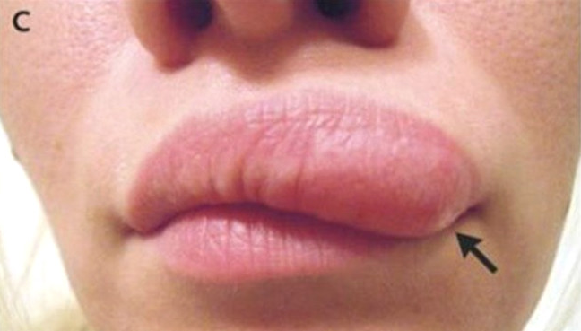 Yüzü birden bu hale gelmeye başladı içinden çıkanlar ise inanılmaz - Resim: 3