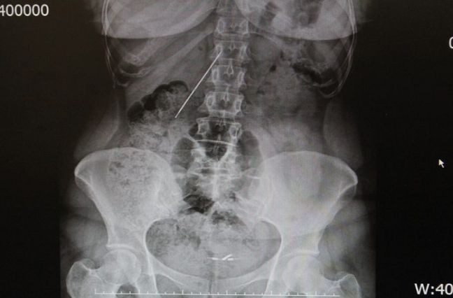 Kahreden gerçeği 15 yaşında öğrendi! 26 yıl sonra hayata yeniden döndü - Resim: 2