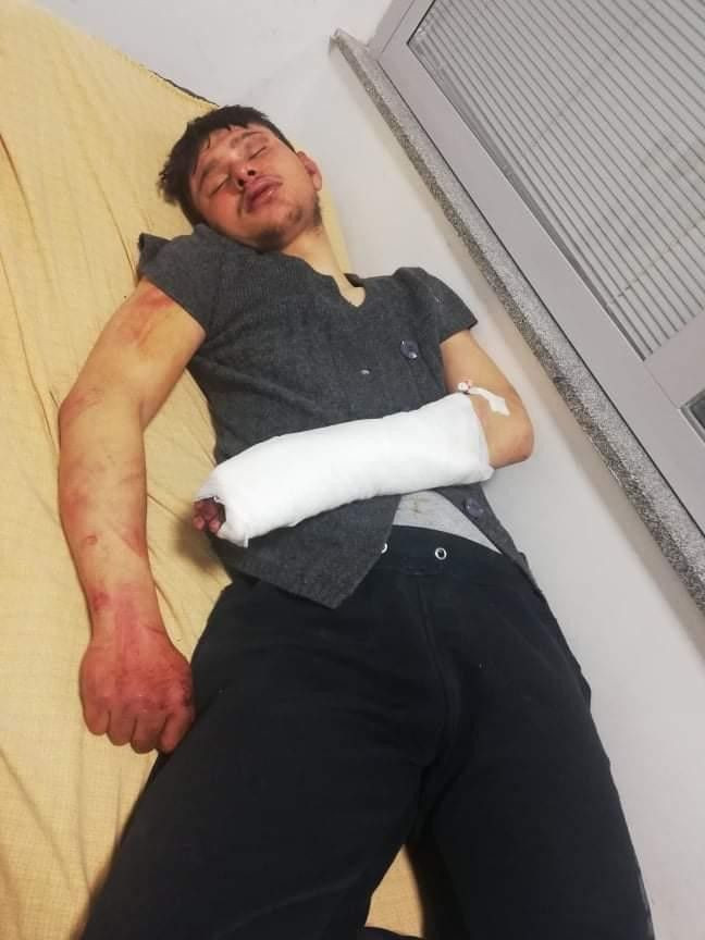 Afyonkarahisar'da 5 saat dövdüler Nazi işkenceleri aratmadı! Sebebi ise şok etti - Resim: 4