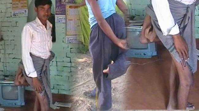 Onlar 4 bacakla dünyaya geldi görünce şoke olacaksınız - Resim: 2