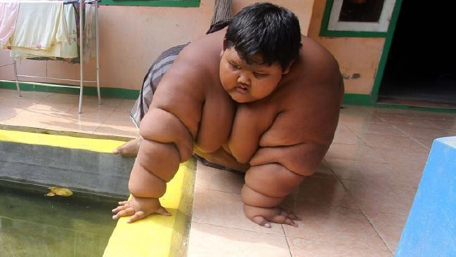 Yetişkin hastalığıydı artık çocuklar da bu hastalığın pençesinde - Resim: 4