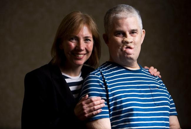 Dişçide iğne oldu kollarını ve bacağını kaybetti! - Resim: 1