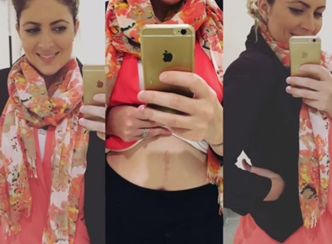 Bu kadın tam 17 yıldır tuvalete gitmiyor! - Resim: 3