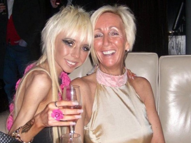 Anoreksiya'dan ölmek üzereydi! Mucizevi değişim herkesi şaşırttı - Resim: 3