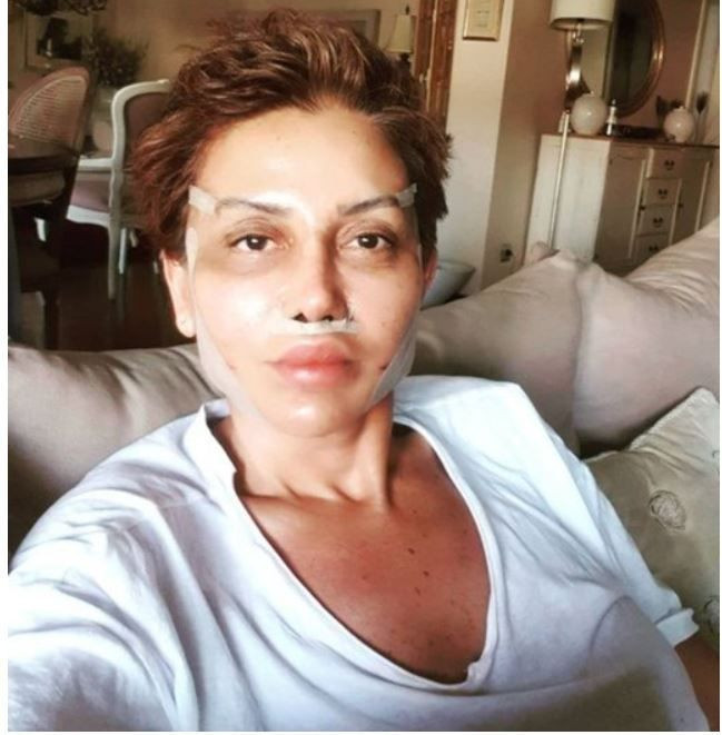 Seda Sayan estetiği yaptıran Serap Paköz'ü kızdırdılar: Beleşçi değilim! - Resim: 2