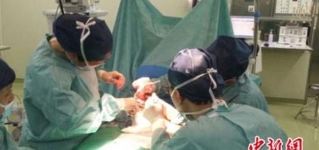 Dünyayı ayağa kaldırdı üç bacaklı çocuk kıyamet alameti gibi - Resim: 1