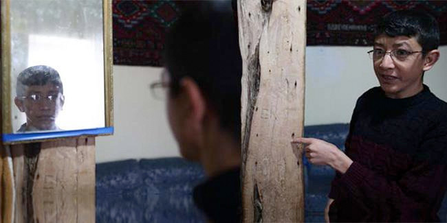 Kayseri'de yaşını duyan inanamıyor! 'Benjamin Button' vakası - Resim: 1