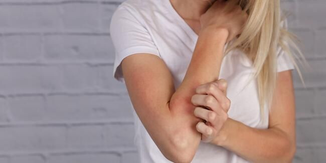 Vücudun verdiği bu sinyallere dikkat eğer sebepsiz morluklar varsa... - Resim: 4