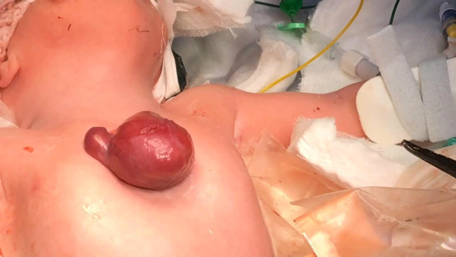 Doktorlar aldır dedi dinlemedi bu halde doğdu - Resim: 4