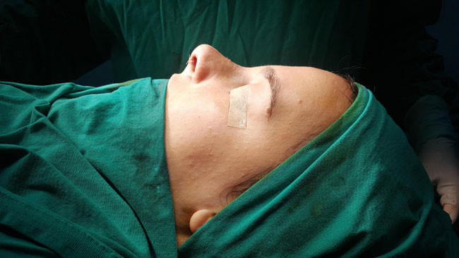 Trabzon'da yeni moda 'Petek Dinçöz burnu' ameliyat olan olana - Resim: 3