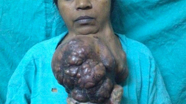 İnanılmaz değişim ikisi de aynı kadın - Resim: 1