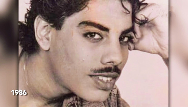 Estetik yaptırayım dedi bu hale geldi sonu ise daha beter - Resim: 1