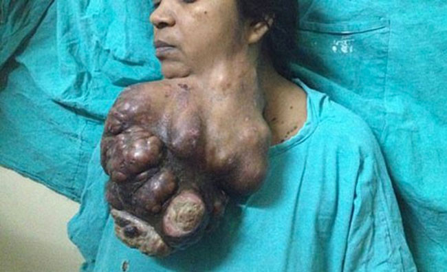 İnanılmaz değişim ikisi de aynı kadın - Resim: 2