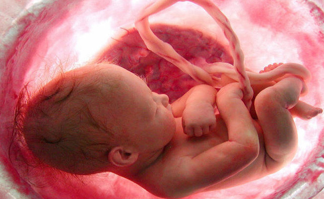 Dikkat dağınıklığı demir eksikliği belirtisi! Demir eksikliği tedavisi nasıl olur? - Resim: 1