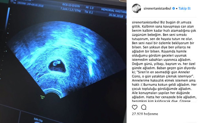 Siren Ertan'ın en acı paylaşımı! Bebeğini kaybetti - Resim: 2