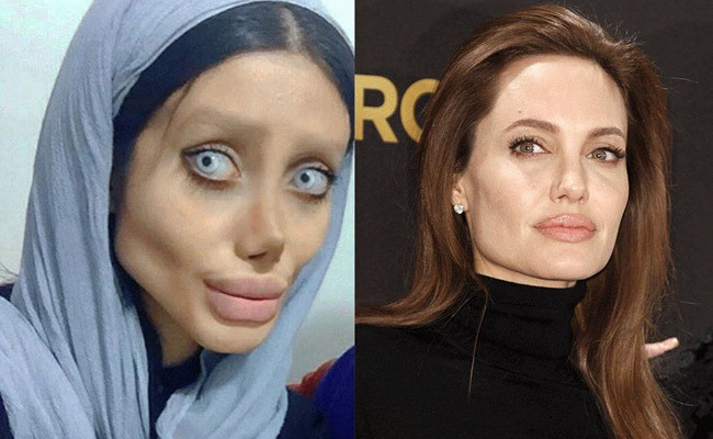 Angelina Jolie'ye benzemeye çalışan İranlı kadının son hali şoke etti! - Resim: 3