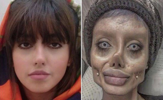 Angelina Jolie'ye benzemeye çalışan İranlı kadının son hali şoke etti! - Resim: 4